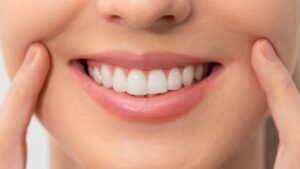 Do teeth whitening kits Work - go4healthnfitness (5)