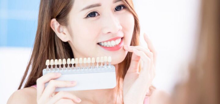 Do teeth whitening kits Work - go4healthnfitness (2)