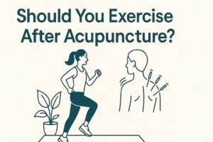 Gym After Acupuncture? Safe Recovery Tips from Experts