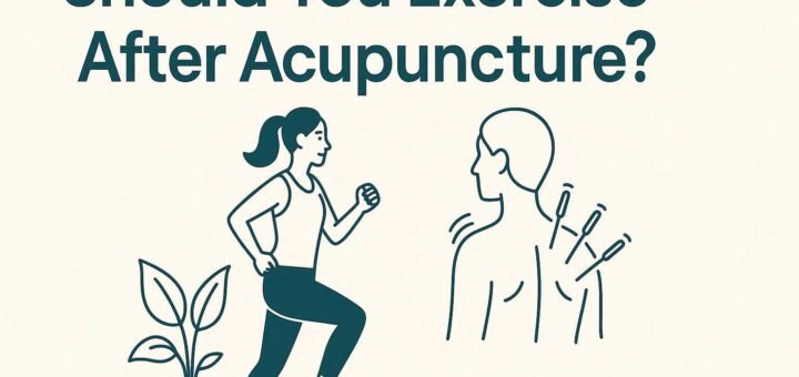 Should You Hit The Gym After Acupuncture? What The Experts Say