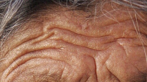 Close-up of pronounced forehead wrinkles on an older woman